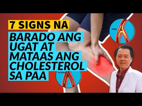 7 Signs na Barado ang Ugat at Mataas ang Cholesterol