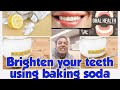 How to clean teeth  | Baking Soda Benefits |  make  shiny teeth | which is the best tooth paste