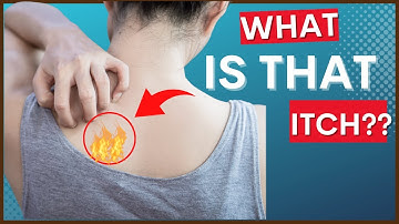 Notalgia Paresthetica (“Itchy Back”) & Causes, Symptoms, & Tips For Treatment