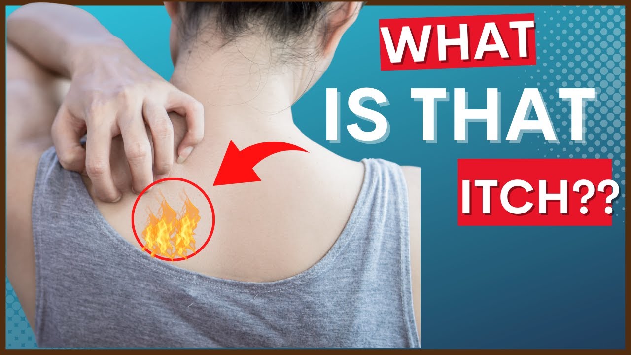 Notalgia Paresthetica Itchy Back Causes Symptoms Tips For notalgia-paresthetica-itchy-back-causes-symptoms-tips-for