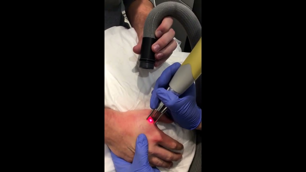 fresh start laser clinic nba tattoo removal austin tx youtube fresh start laser clinic nba tattoo removal austin tx youtube