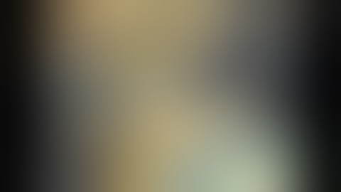 Laparoscopic appendectomy (complete with explanation)