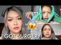 what REALLY happens when you get DOUBLE JAW SURGERY (The Ugly Truth) pt.1