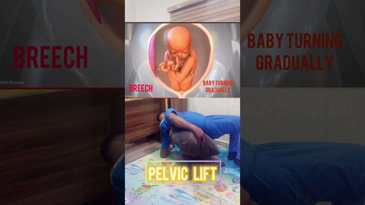How To Turn Baby S Head Down During Pregnancy Pregnant Fyp