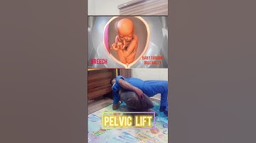 How to turn baby’s head down during pregnancy. #pregnant #fyp