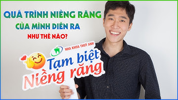 Quá trình Niềng răng chữa khớp cắn đối đầu của mình diễn ra như thế nào?