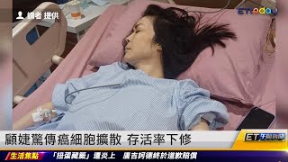 顧婕驚罹直腸癌第4期 癌細胞擴散至肝臟｜20240516 ET午間新聞