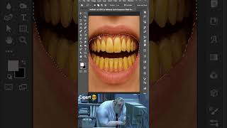 Teeth Whitening in Photoshop