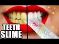Dentes DIY Whitening SLIME! Dentes mais brancos em 2 minutos! Natalies saída