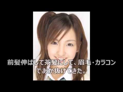 板野友美整形認めた 目 鼻 口 アゴ徹底分析 ともちんこと板野友美の整形遍歴 Youtube