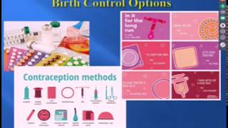 Contraception Options 1/30/19