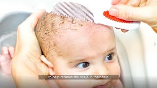 4 cradle cap tips from dermatologists