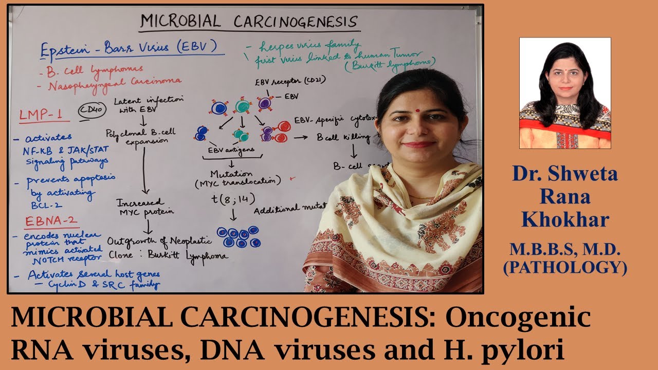 MICROBIAL CARCINOGENESIS: Oncogenic RNA viruses, DNA viruses and H. pylori