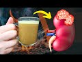 Remove Toxins from Your Kidneys // Even The Doctors Are Amazed