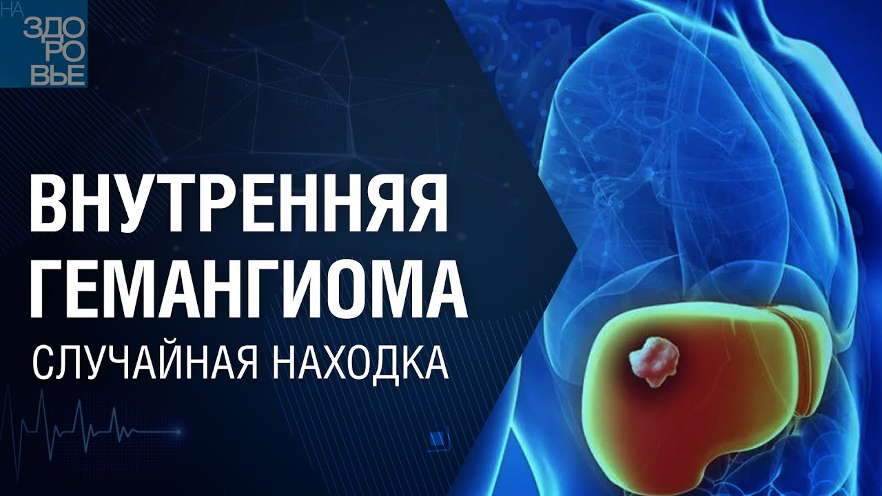 Внутренняя гемангиома. Случайная находка. На здоровье 18.12.2021