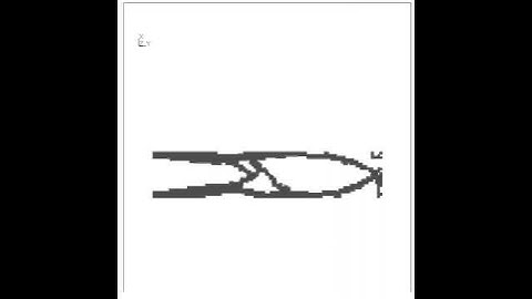 Topology optimization based on the Bi-directional Evolutionary Structural Optimization (BESO) method