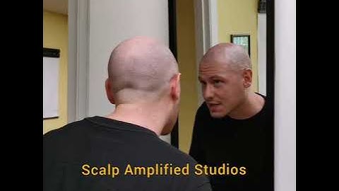 First sessions of Scalp Micropigmentation (SMP) are always amazing for the clients and technicians 😍