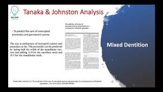 Tanaka and Johnston Analysis Simplified in 2 minutes