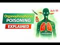 Organophosphorus Poisoning Explained