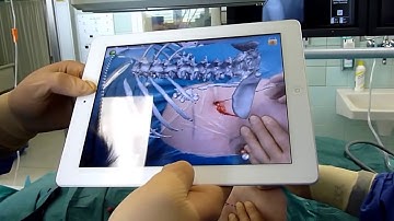 Surgery Pad - mobile medical augmented reality App for the Apple iPad