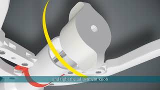 Langhe Medical Disposable Circision Suture Device Operation Video - Demo