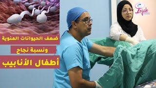 ضعف الحيوانات المنوية ونسبة نجاح أطفال الأنابيب