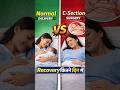 किस में टांके जल्दी ठीक होते है? normal delivery ya c section?