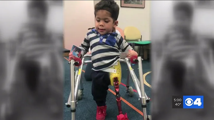 Metro East family asking for help finding boy's stolen prosthetic leg