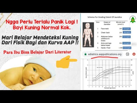 Bayi Kuning? Jangan Panik..! Yuk Kenali Bayi Kuning Yang Normal dan Berbahaya - Part 1/2