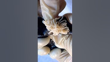 Mochi Pimple Popping #pimplepopping #satisfying #visualasmr #relax #cats #oddlysatisfying