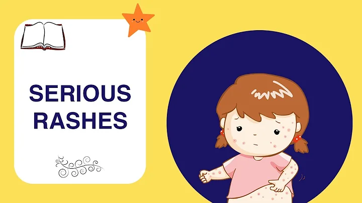 Rare serious rashes (Stevens-Johnson Syndrome, Toxic Epidermal Necrolysis) in the paediatric ED