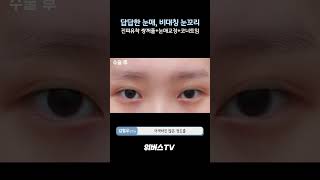 답답한 눈매, 비대칭 눈꼬리 고민이라면