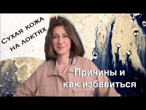 Очень СУХИЕ ЛОКТИ: причины и чем лечить