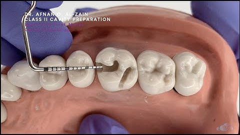 Class II cavity preparation for amalgam - maxillary molar #26 - Preclinical Operative - Arabic عربي