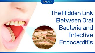 ► The Hidden Link Between Oral Bacteria and Infective Endocarditis