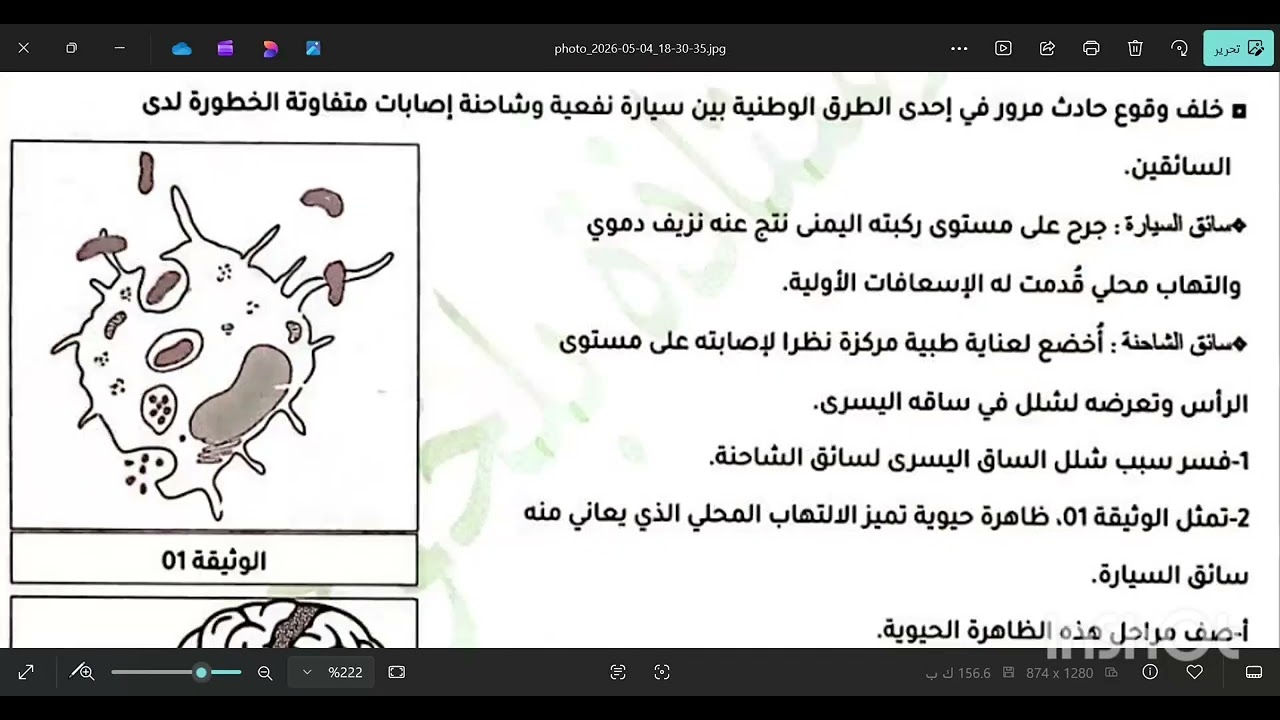 حل تمارين متنوعة مقترحة لامتحان#شهادة_التعليم_المتوسط #علوم_الطبيعة_و_الحياة 