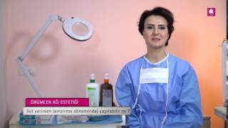 Örümcek Ağı Estetiği Süt Verirken Emzirme Döneminde Yapılabilir Mi?