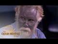 A Look Back at the Man Who Turned Blue | The Oprah Winfrey Show | Oprah Winfrey Network