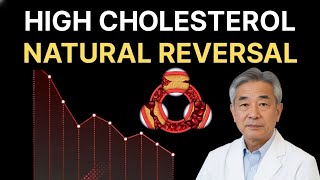 If I Had HIGH CHOLESTEROL, Didn't Want STATIN: Here's EXACTLY What I'd Do (You Never Imagine)