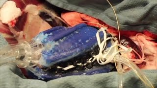 Soft robot helps the heart