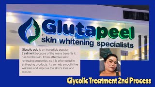 THE 2ND PROCESS OF MY GLYCOLIC FACIAL TREATMENT AT GLUTAPEEL SKIN WHITENING SPECIALISTS PART 2