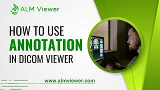 How to Use Annotation in Dicom Viewer | By Alm Viewer