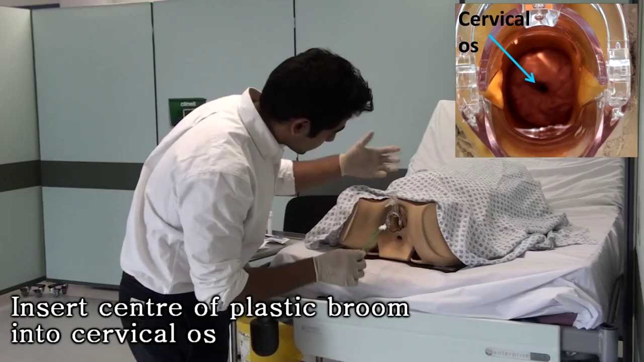 Speculum Exam And Cervical Smear Youtube 