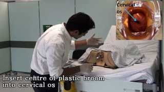 Speculum Exam And Cervical Smear Speculum Exam And Cervical Smear