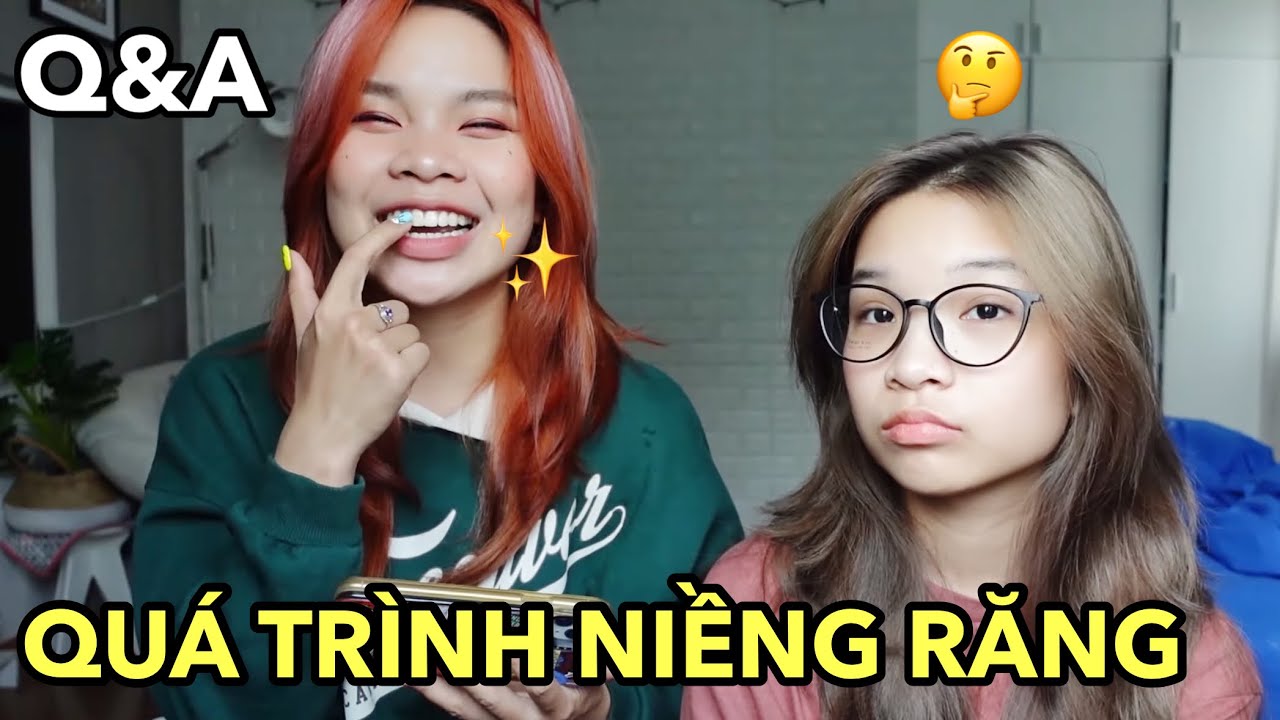 Q&A: quá trình niềng răng của Song Thư (niềng mắc cài, niềng trong suốt,...)