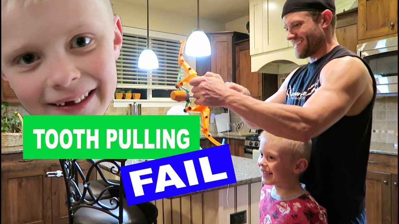 TOOTH PULLING FAIL! OPEN ADOPTION VLOG
