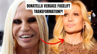 DONATELLA VERSACE FACELIFT TRANSFORMATION?! 😍😱