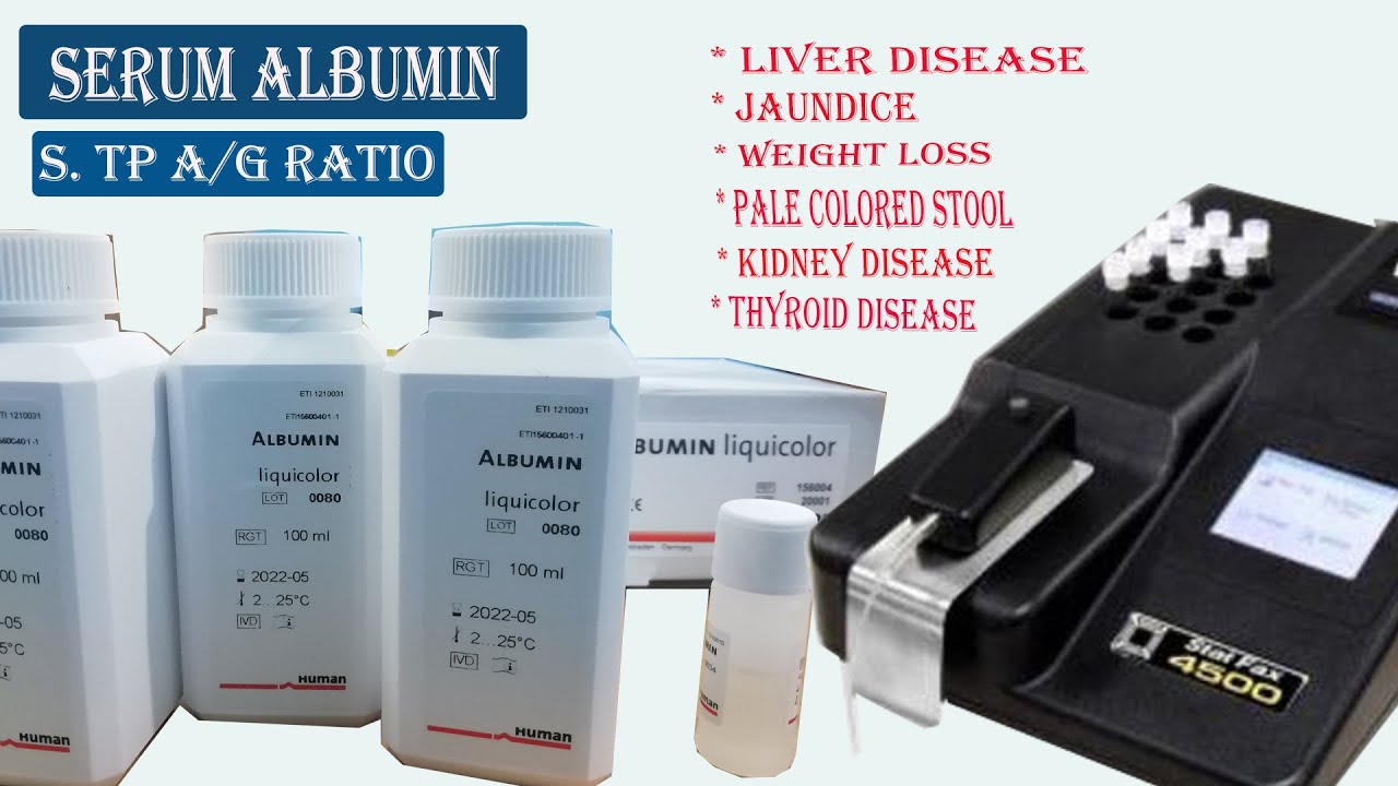 Serum Albumin Test Procedure Total Protein Albumin Globulin Ratio