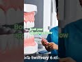 teeth kise cleaning ho ga #dentist #trendingnow #viralvideo