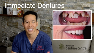 Immediate Dentures! From terminal teeth to beautiful smile